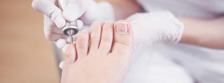 cuidado adecuado de las uñas de los pies